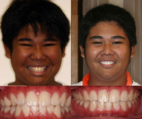 before and after