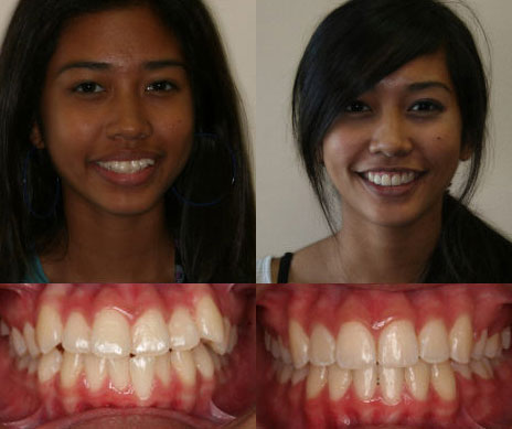 before and after