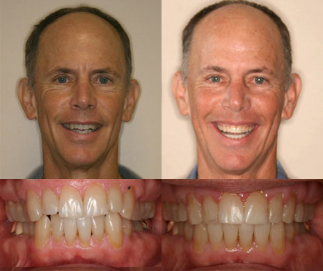 before and after